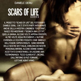 La serie “Scars of life” di Daniele Deriu a Torino