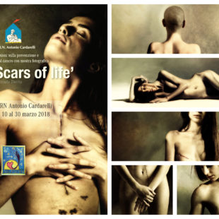 Scars of life al Cardarelli di Napoli – daniele deriu